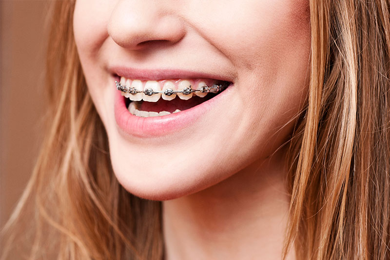 Vallejo Orthodontics